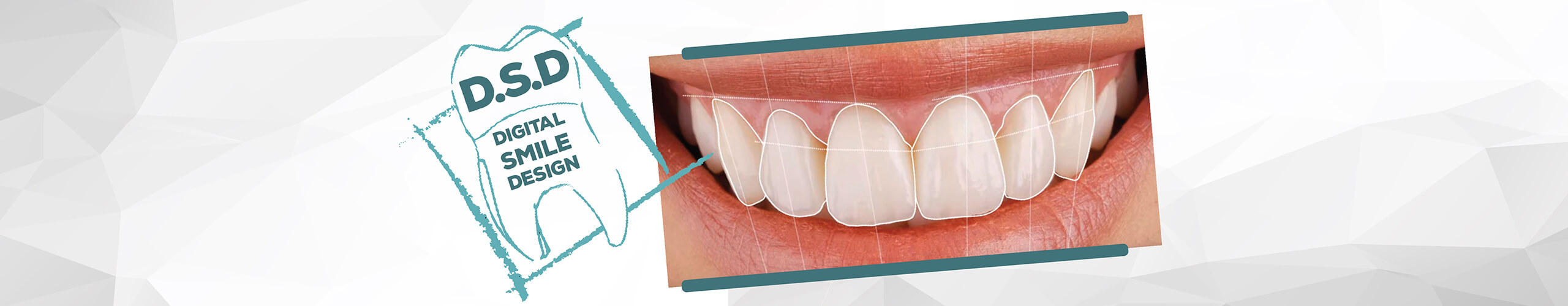 Digital Smile Design